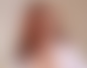 00236_Stroke