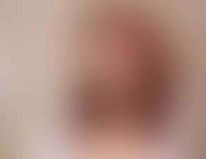 00236_Stroke