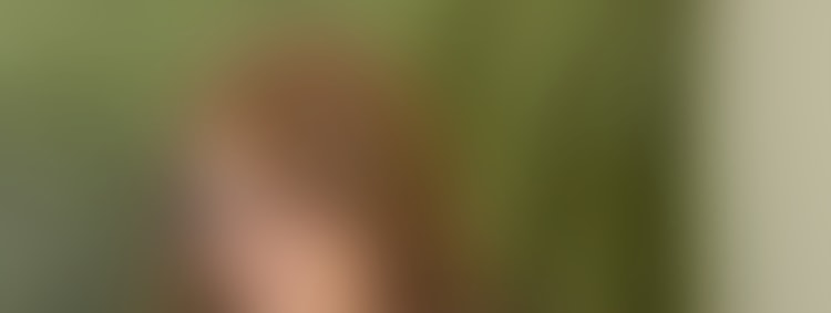 00977_SMDR